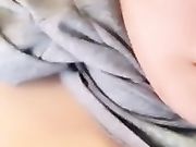 气质G奶主播小奶瓶会员福利展示刚刮完毛毛的逼 逼逼上火了吧貌似长痘痘了