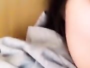 气质G奶主播小奶瓶会员福利展示刚刮完毛毛的逼 逼逼上火了吧貌似长痘痘了